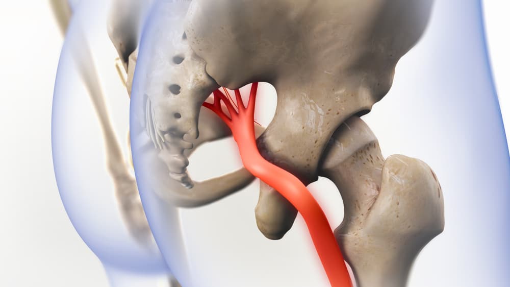 Nerve Flossing