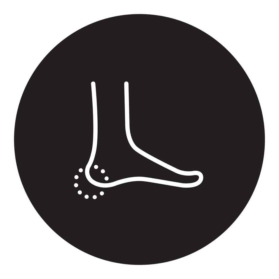 Heel Pain